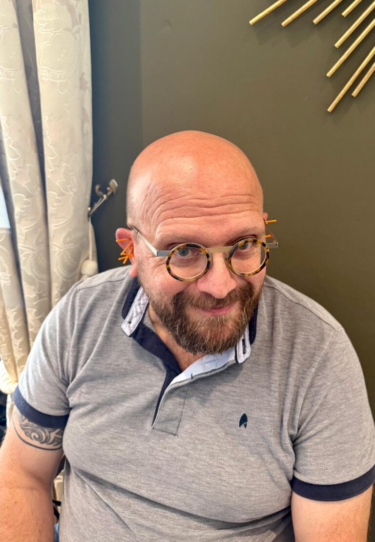 A smiling participant in glasses and a gray polo shirt with ear needles in place