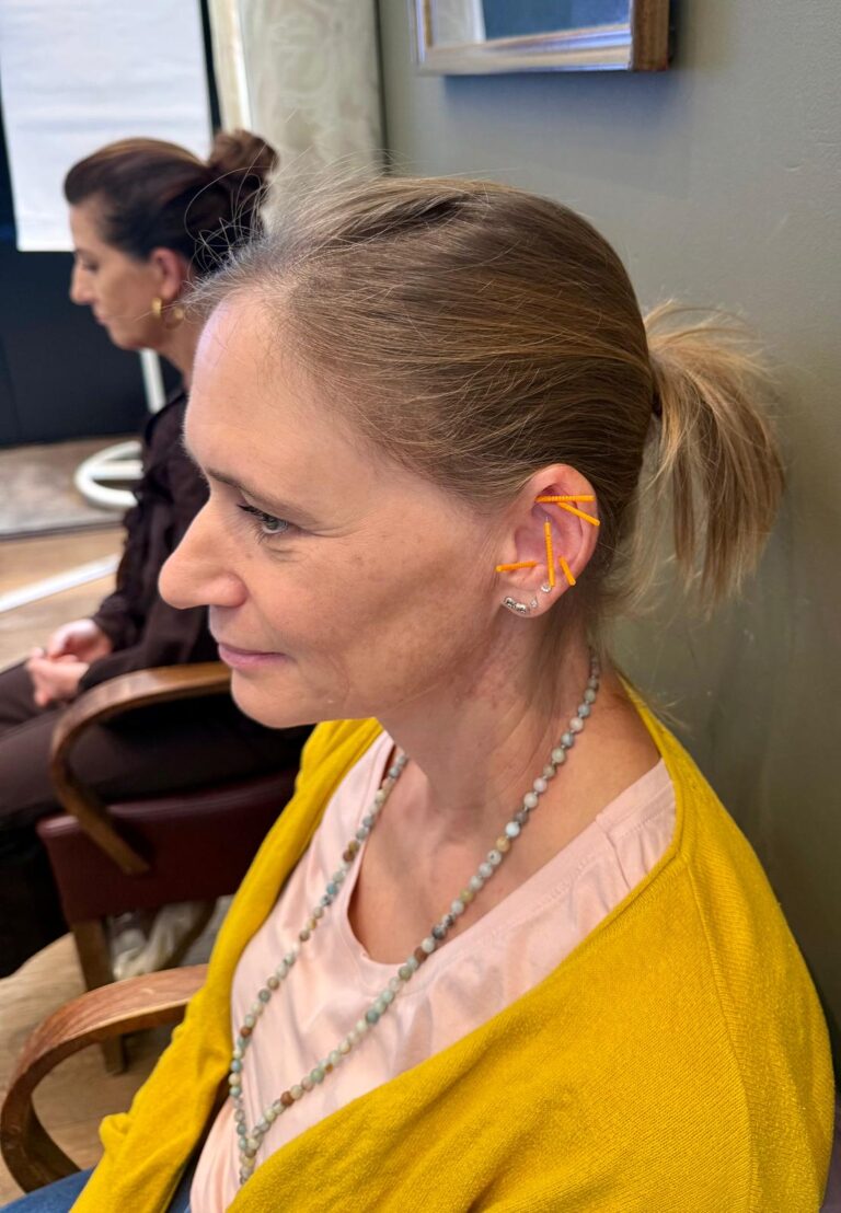 A participant in a yellow cardigan receiving ear acupuncture while others sit nearby